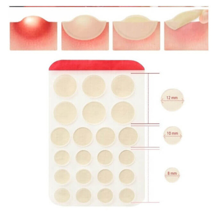 ELIZAVECCA Точечные патчи для удаления акне, 44шт